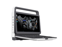 Mobilny aparat USG Zoncare M30 z głowicą convex